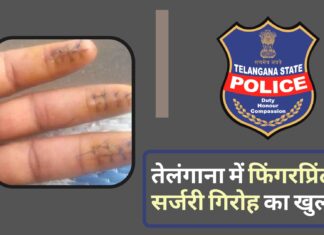 तेलंगाना में फिंगरप्रिंट सर्जरी गिरोह का खुलासा; खाड़ी देशों से निकाले गए दोषियों की उंगलियों के निशान बदलते थे। तेलंगाना में फिंगरप्रिंट सर्जरी गिरोह का खुलासा; खाड़ी देशों से निकाले गए दोषियों की उंगलियों के निशान बदलते थे।